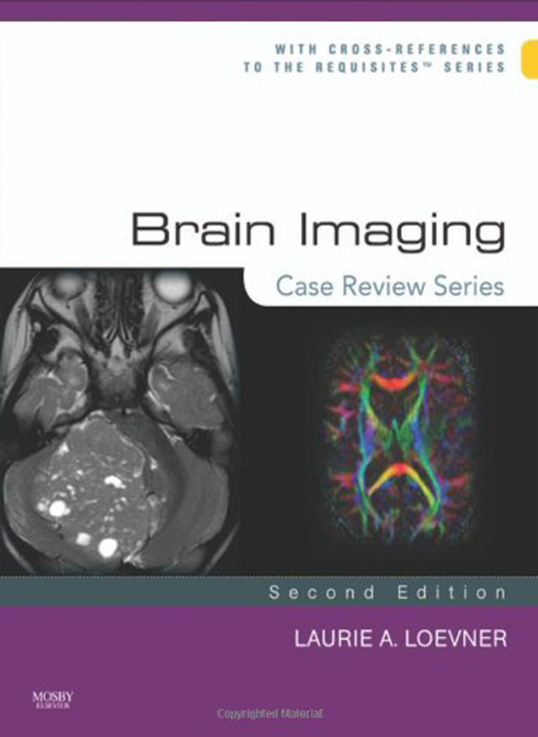 Brain Imaging Case Review Series - Scrubs Continuing Education®