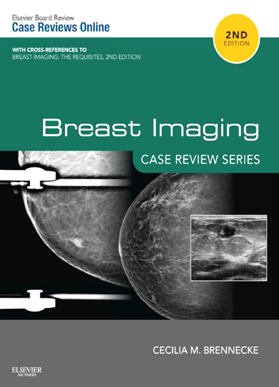 Only　Breast　Continuing　Review　Imaging　Scrubs　Case　Emailed　Test　Series　Education®