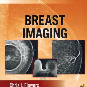 Breast Imaging Radiology Review