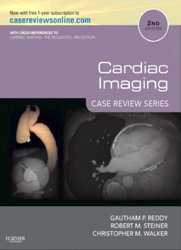 Cardiac Imaging Case Review Series