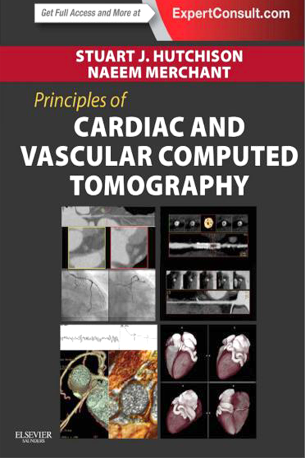 Cardiac and Vascular Computed Tomography