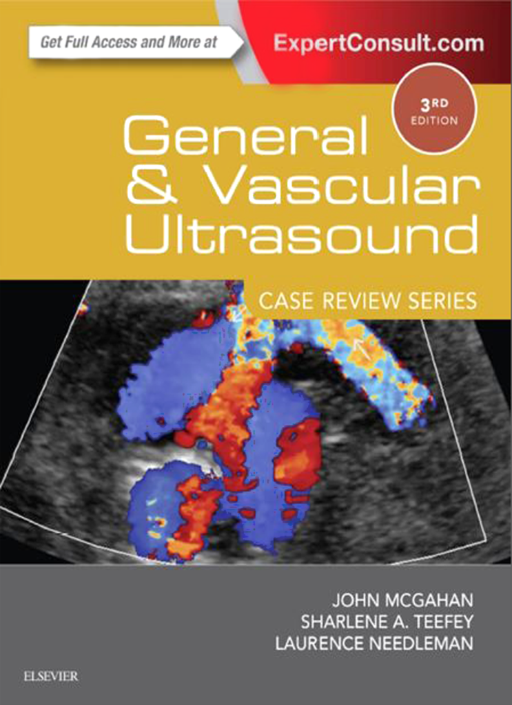 General and Vascular Ultrasound CRS