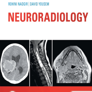 Neuroradiology the Requisites