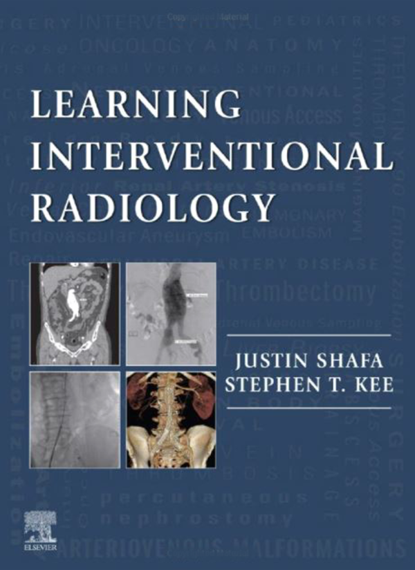 Interventional Radiology Procedures