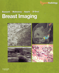 Digital Mammography & Percutaneous Stereotactic Biopsy