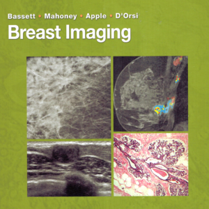 Digital Mammography & Percutaneous Stereotactic Biopsy